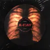 X-Ray